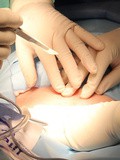 Faire des opérations de chirurgie sur sa silhouette après une grossesse : où aller