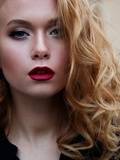 Quels sont les atouts de la greffe de cheveux en Hongrie