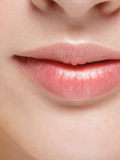 Rides verticales de la lèvre supérieure: solutions pour retrouver une bouche jeune